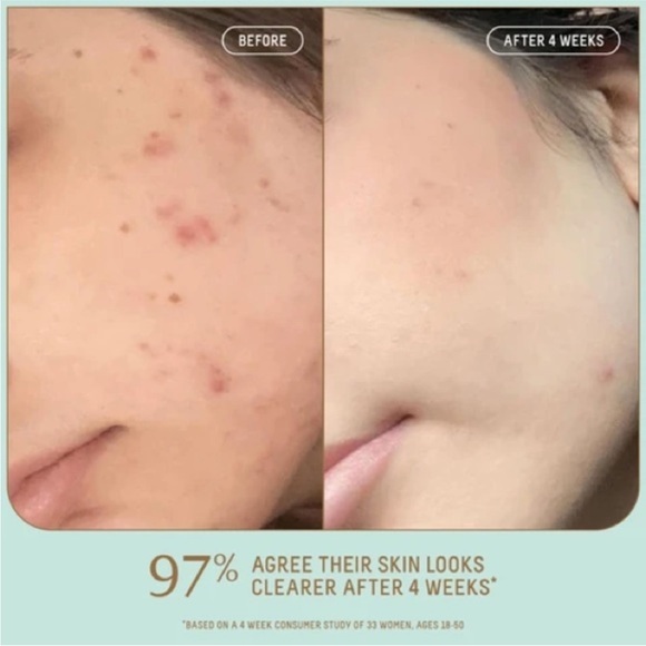 Biossance Squalane + Probiotic Gel Moisturizer Travel Size 15mL / 0.5oz - Picture 3 of 5